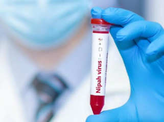 Petugas kesehatan melakukan skrining deteksi dini virus Nipah di fasilitas medis Indonesia