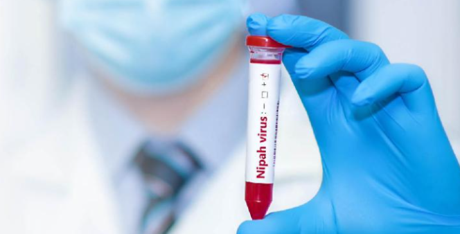 
Petugas kesehatan melakukan skrining deteksi dini virus Nipah di fasilitas medis Indonesia